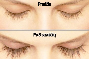 rezultatas po naudojimo